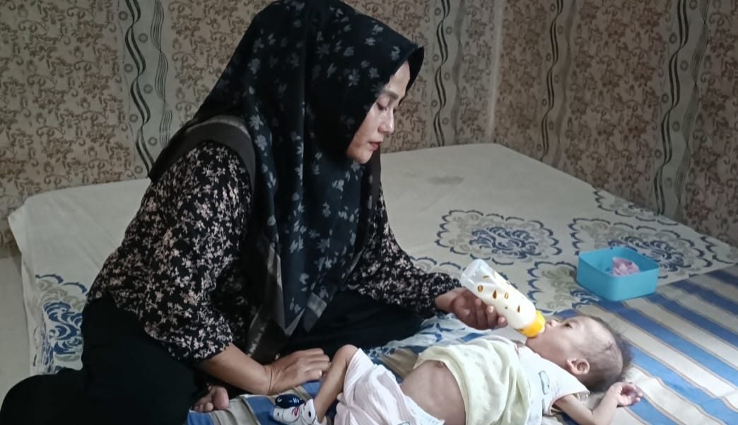 Bayi Perut Bengkak